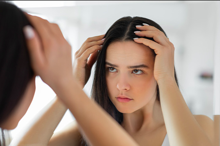 Penyebab Ketombe Rambut Dan Tips Pilih Sampo