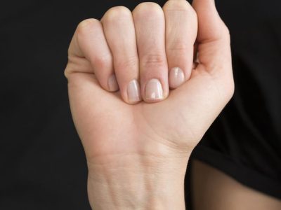 Perubahan Warna Kuku