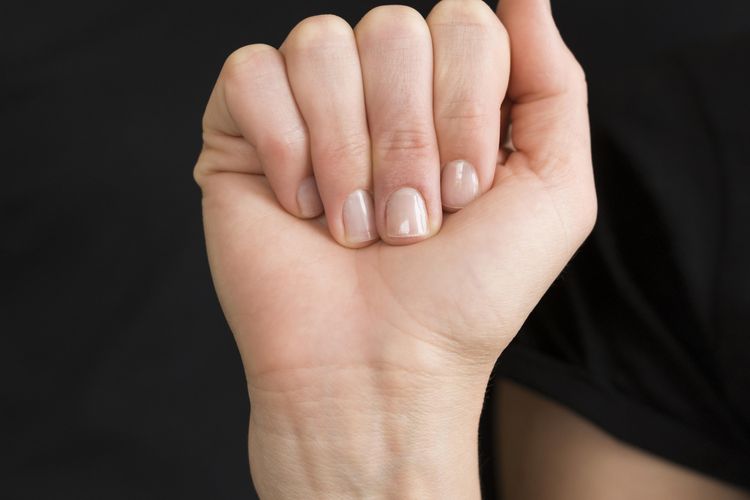 Perubahan Warna Kuku Menjadi Tanda Masalah Kesehatan