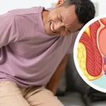 Wasir Kambuh Terus? Coba Cek Lagi Kebiasaan Toiletmu