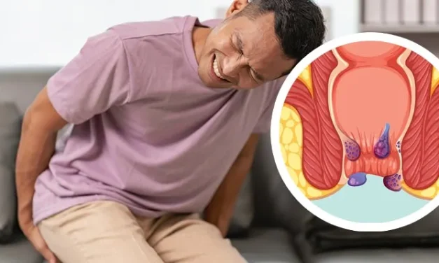 Wasir Kambuh Terus? Coba Cek Lagi Kebiasaan Toiletmu