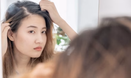 Biotin Ampuh Obati Kebotakan? Ini Kata Dokter